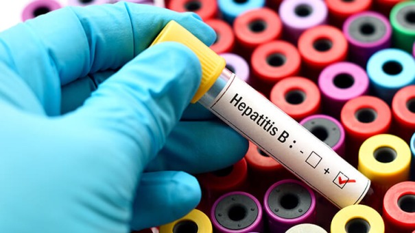 Everything you should know about Hepatitis B on this World Hepatitis Day